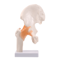 مجسم مفصل الفخذ