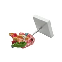 مجسم أمراض البنكرياس والمرارة والاثنين عشر