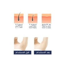 جهاز إزالة الشعر IPL المنزلي