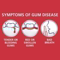 بارودونتكس معجون أسنان 50 مل إكسترا فريش