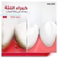 بارودونتكس معجون أسنان ترميم فعال للثة نعناع منعش...