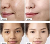 كريم ريتينول لتبييض البشرة، مرطب للوجه للبشرة الجا...