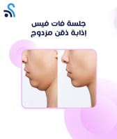 جلسة فات فيس (إذابة ذقن مزدوج ودهون أسفل الوجه)