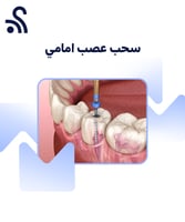 سحب عصب امامي