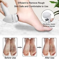 باديكير إلكتروني