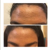 مقشر الاحماض-ذا اورديناري PEELING SOLUTION 30ML