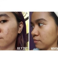 مقشر الاحماض-ذا اورديناري PEELING SOLUTION 30ML