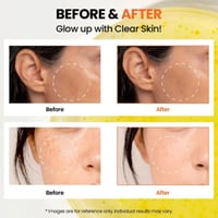 كي سيكريت سيول 1988 سيروم توهج نياسيناميد 15% وخلا...