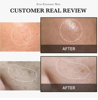 ميديكيوب امبولة الوجه اكسوسوم شوت 2000 معزز للبشرة...