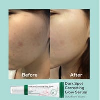 أكسيس واي سيروم تفتيح البقع السوداء 50 مل