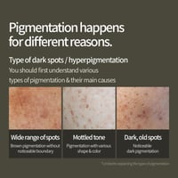 سيروم عيوب البشرة فيتا سي من جرين ليمون، للجنسين،...