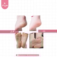 قفازات وجوارب الساونا