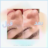 جهاز الهايدرافيشل