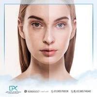 جلسة تنظيف بشرة بالهيدرافيشال د.سعد الصقير