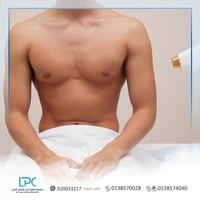 ليزر منطقة الجذع ( الظهر والصدر والبطن ) (الرجال)
