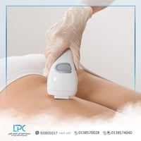 ليزر منطقة الأرداف (السيدات )