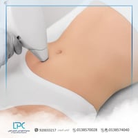 ليزر خط البطن (السيدات )