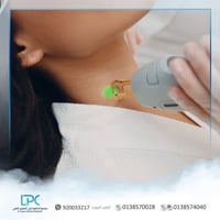 ليزر منطقة الوجه و الرقبة (السيدات أو الرجال)