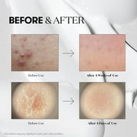 ريدل شوت 300 لتعزيز النعومة وتجديد البشرة من في تي...