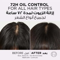 شامبو الفيف هيالورون بيور المنقي لفروة الرأس من لو...