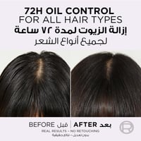 سيروم الفيف هيالورون النقي لفروة الرأس والجذور الد...