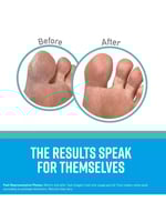 قناع الترطيب المكثف للأقدام الجافة والخشنة من اوكي...