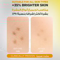 سيروم فيتامين سي للتفتيح ومضاد للبقع من غارنييه –...