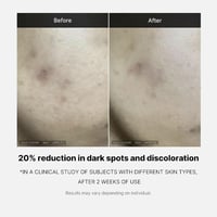 أمبولات فيتامين سي لتحسين لون البشرة من ميديكيوب –...