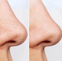 غسول زيتي هارتليف للتحكم في المسام من أنوا – 200 م...