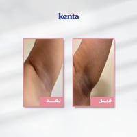 مجموعة كينتا بخلاصة زيت الورد