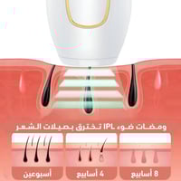 جهاز IPL لإزالة الشعر بالليزر