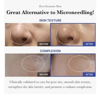 سيروم الوجه ميديكيوب وان داي إكسوزوم شوت 7500 سبيك...