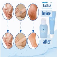 مجموعة إزالة الجلد الميت والعناية بالقدم من بلسـان