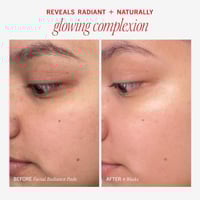 First Aid Beauty Facial Radiance Pads with Glycoli...