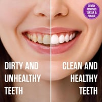 سبرينجين معجون أسنان للحساسية واللثة - 142 جم