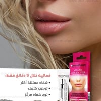 فيلر تعزيز الشفاه من ديرموفيوتشر