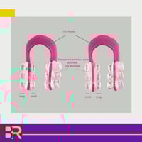 مقوم انف وردي