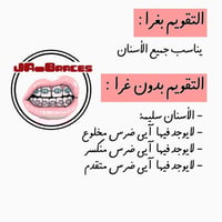 فك بدون غرا منفصل "الشحن مجانًا "