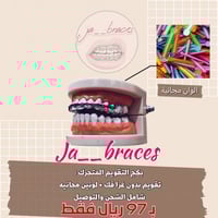 تقويم اسنان زينة (بكج) فك بدون غرا متصل " شامل الش...