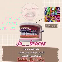 تقويم اسنان زينة (بكج)فك بغرا متصل " شامل الشحن "