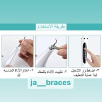 جهاز الترا لتنظيف الاسنان