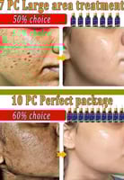 إزالة المسام الكبيره سيروم انكماش المسام