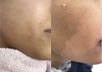 عرض مجموعة تفتيح الوجه الأكثر مبيعاَ