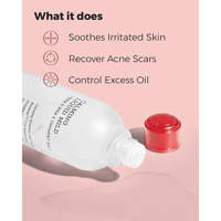 سائل مهدئ خفيف من مجموعة ايه سي من كوزركس 125مل