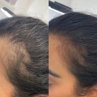 برنامج مسار العناية بالشعر