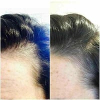 برنامج مسار العناية بالشعر