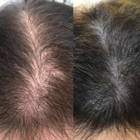 برنامج مسار العناية بالشعر