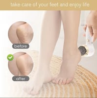 مزيل مسامير القدم الكهربائي القابل لإعادة الشحن، م...