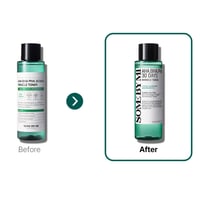 تونر أحماض التقشير المعجزة