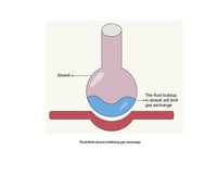 Clinical Concepts in Respiratory & Critical Care